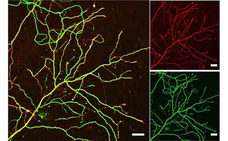 Получены норадреналиновые нейроны из стволовых клеток человека