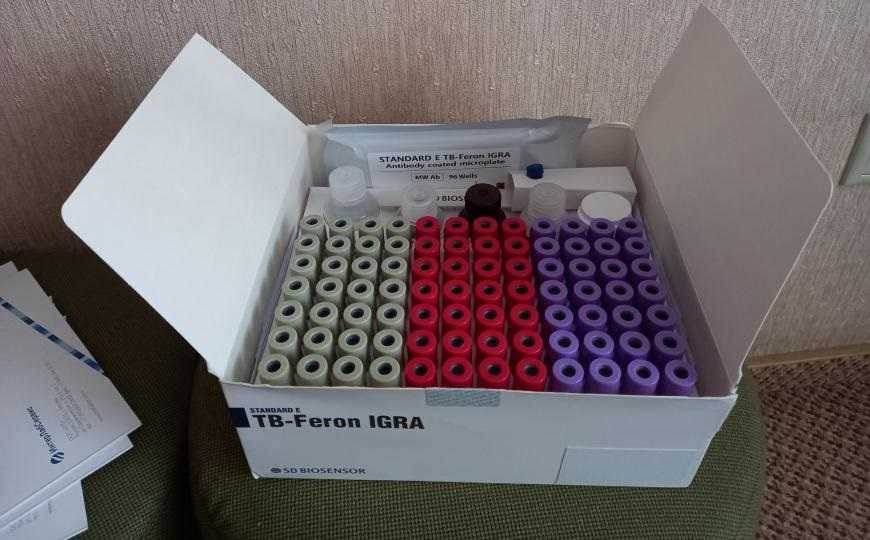 Интерфероновый тест на туберкулез TB-Feron работает точнее остальных за счет особого дизайна антигенов