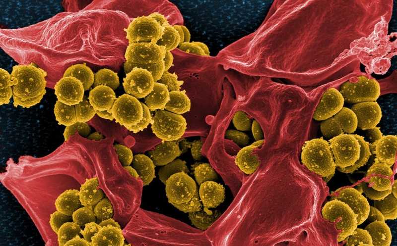 Пять причин узнать больше о резистентности к антибиотикам