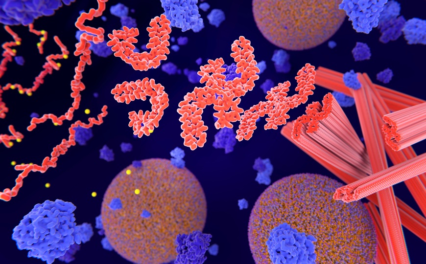 Новый биомаркер снижает число ошибочно диагностированных случаев болезни Альцгеймера