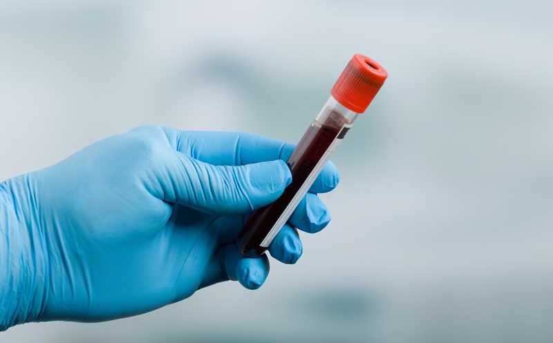 Протеом крови помогает оценить риски развития 67 распространенных и редких заболеваний