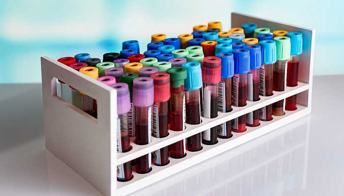 Онкомаркер CA 19-9 поможет спрогнозировать выживаемость при ...