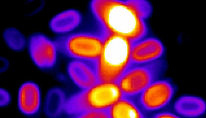 Как покоящиеся споры бактерий понимают, что пора прорастать — PCR News