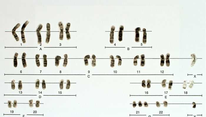 Неинвазивный пренатальный скрининг: как правильно?