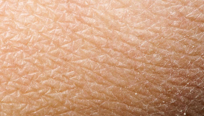 Болезнь Паркинсона можно диагностировать по биопсии кожи — PCR News