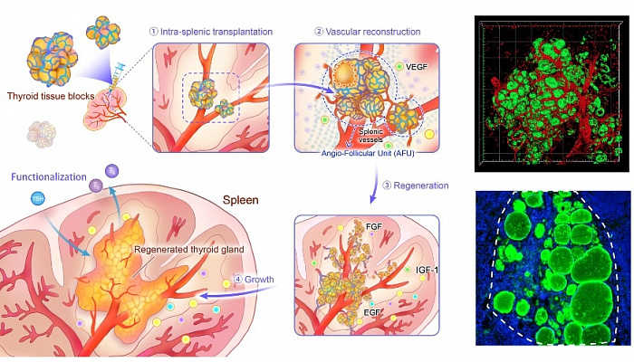 Щитовидную железу можно вырастить в селезенке — PCR News